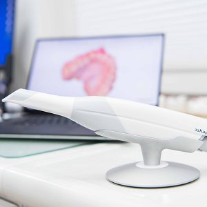 Digitaler Abdruck mit Intraoralscanner